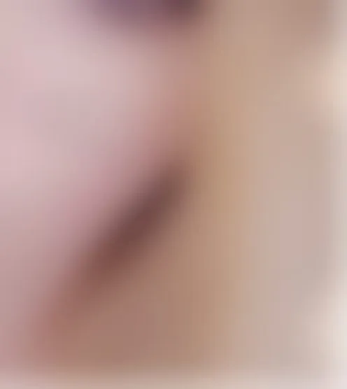 A********4