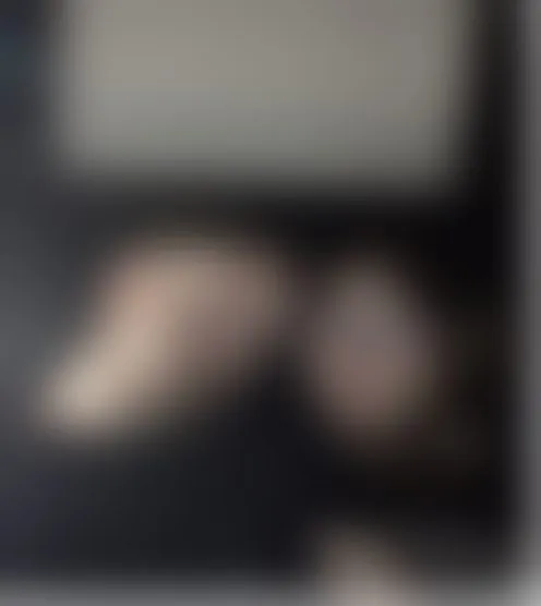E*****2
