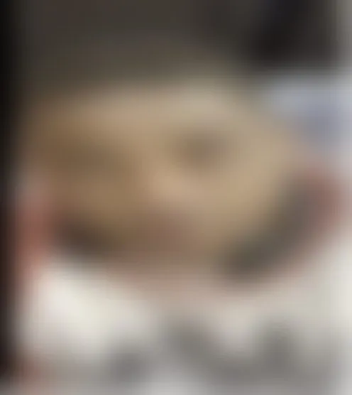 A***********l