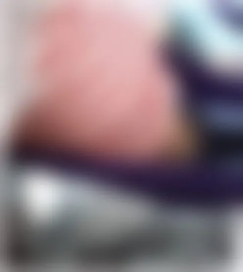 A******a