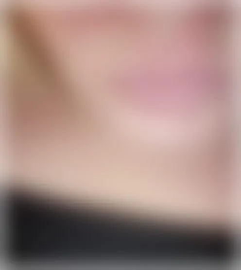 R****e