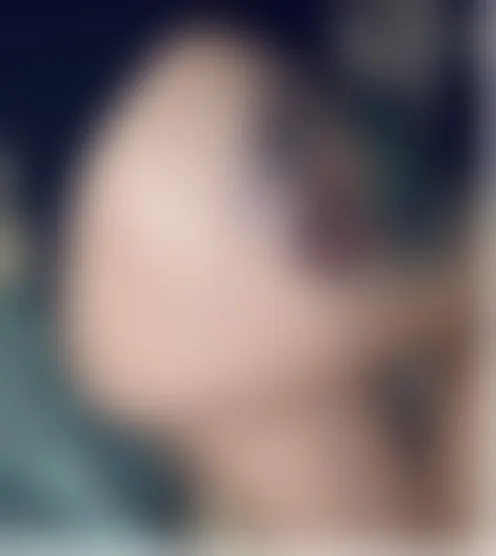 b********1