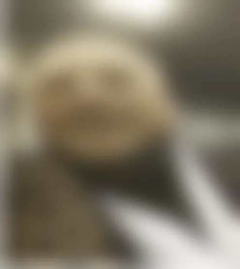 L**********A
