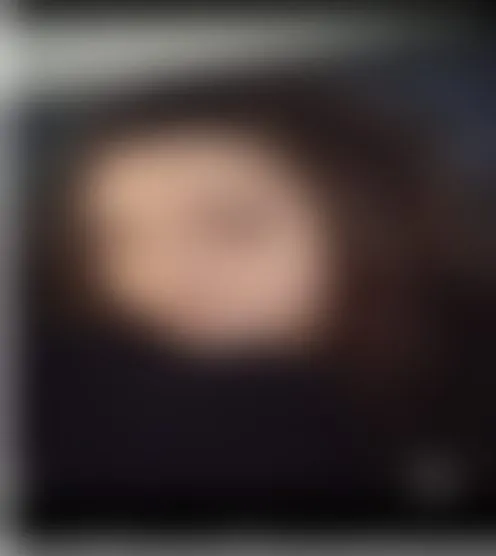 L***a