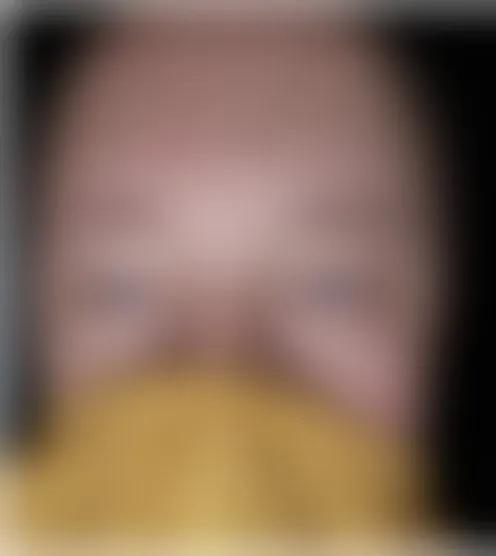 B****e