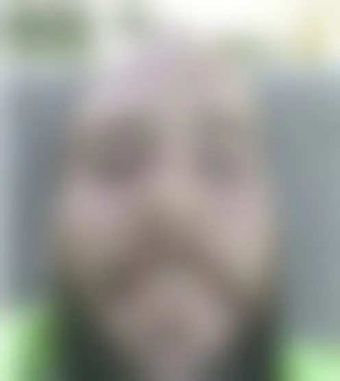 b***********2