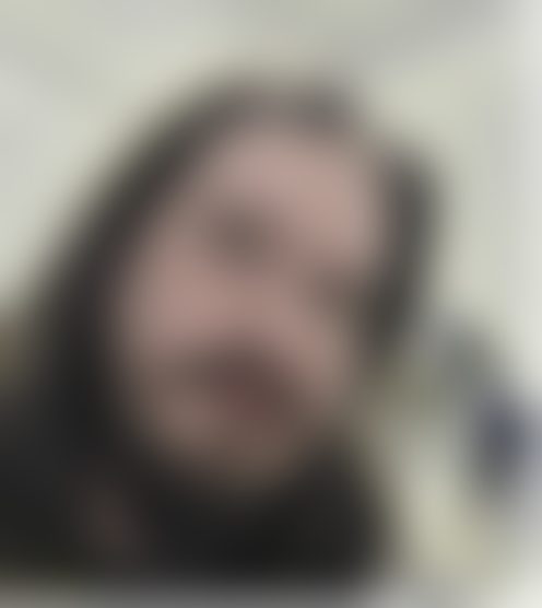 o****1