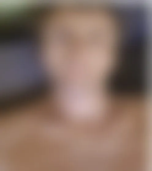 A****a