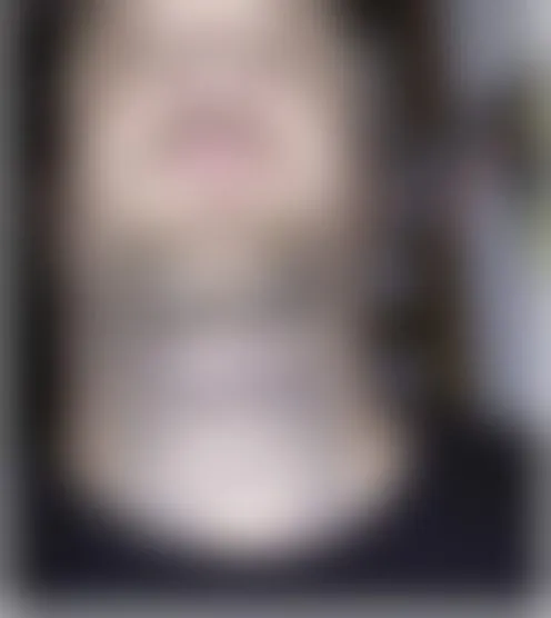 T***r