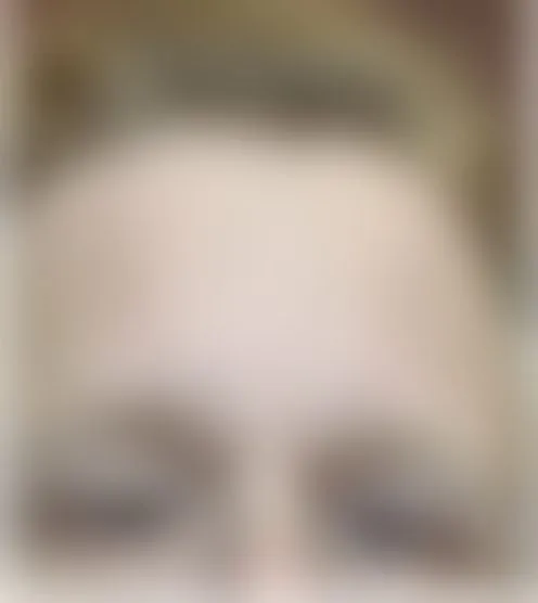 R**s