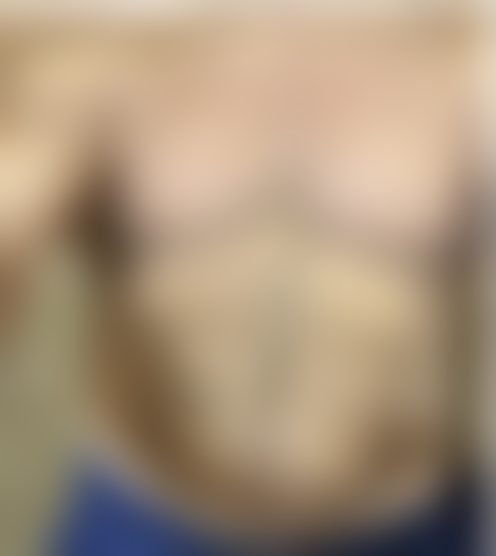 M**k