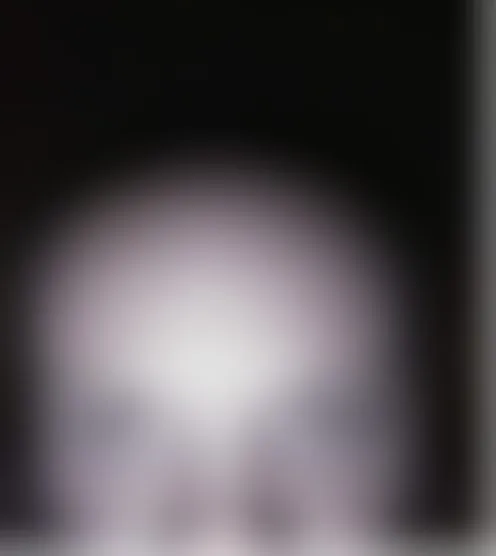A***n