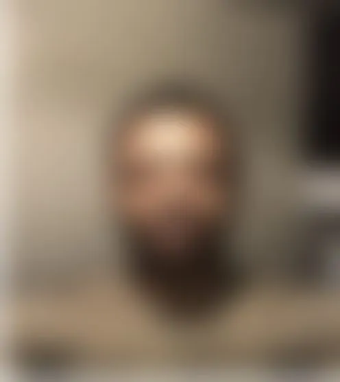 1*****1
