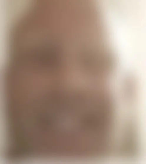 C********a