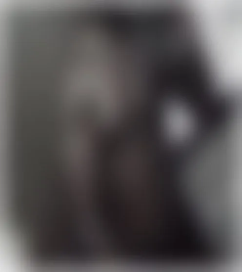 D****P