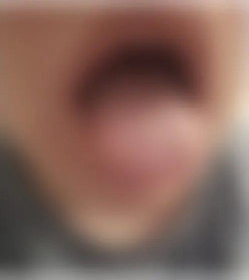 w********e